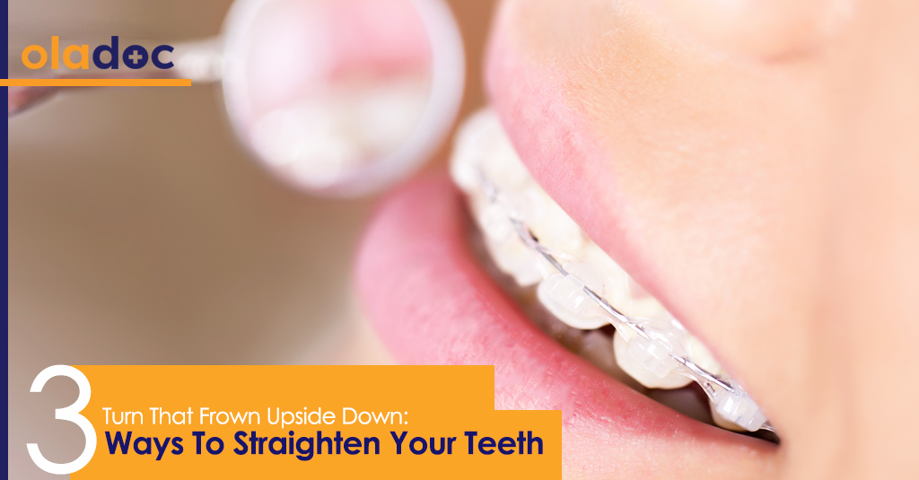 Get The Perfect Smile 3 Ways To Straighten Your Teeth Teeth and Gums