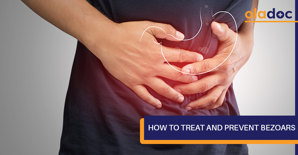 How to Treat and Prevent Bezoars? Digestive Health